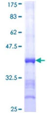 SDS-PAGE - Recombinant Human SERCA1 ATPase protein (AB152208)