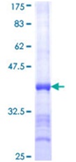 SDS-PAGE - Recombinant Human SERCA1 ATPase protein (GST tag N-Terminus) (AB152208)