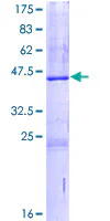 SDS-PAGE - Recombinant Human Serglycin protein (AB116977)