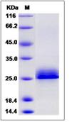 SDS-PAGE - Recombinant Human Serglycin protein (Tagged) (AB276571)