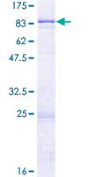 SDS-PAGE - Recombinant Human Serine Palmitoyltransferase protein (GST tag N-Terminus) (AB152996)