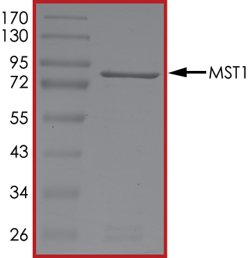 SDS-PAGE - Recombinant human Serine/threonine-protein kinase 4/MST-1 (AB60337), expandable thumbnail