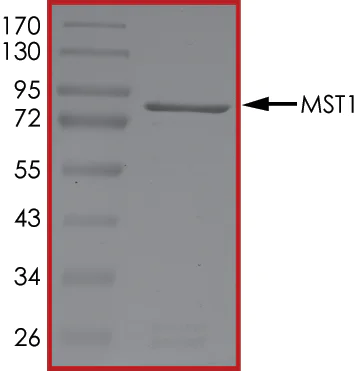 SDS-PAGE - Recombinant human Serine/threonine-protein kinase 4/MST-1 (AB60337)