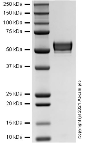 Recombinant Human Serpin A1/alpha-1-Antitrypsin Protein