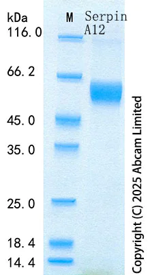 SDS-PAGE - Recombinant Human Serpin A12 Protein Standard (His tag) (AB316717)