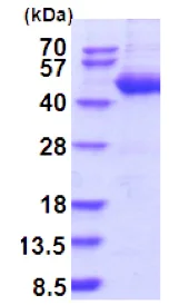 SDS-PAGE - Recombinant Human SerpinB4/SCCA-2 protein (His tag N-Terminus) (AB202597)