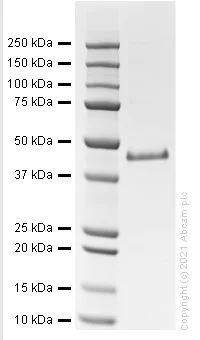 SDS-PAGE - Recombinant Human SERPINE1 Protein (Active) (AB282405)