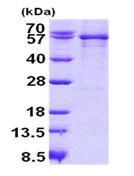 SDS-PAGE - Recombinant Human SERPING1 protein (denatured) (His tag N-Terminus) (AB140591)
