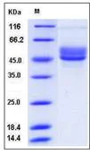 SDS-PAGE - Recombinant Human SERPINI2 protein (His tag) (AB276350)