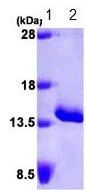 SDS-PAGE - Recombinant Human Serum Amyloid A protein (AB87757)