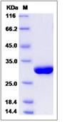 SDS-PAGE - Recombinant Human Serum Amyloid P/SAP protein (His tag) (AB276564), expandable thumbnail