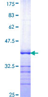 SDS-PAGE - Recombinant Human Serum Response Factor SRF protein (AB114319), expandable thumbnail