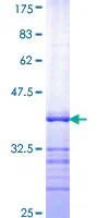 SDS-PAGE - Recombinant Human Serum Response Factor SRF protein (GST tag N-Terminus) (AB114319)