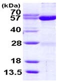 SDS-PAGE - Recombinant Human Seryl-tRNA synthetase/SERS protein (AB116194)