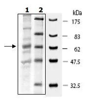 SDS-PAGE - Recombinant Human SESN2/Sestrin-2 protein (DDDDK tag N-Terminus) (AB196408)