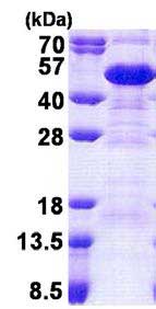 Western blot - Recombinant Human SET/TAF-I protein (AB167879), expandable thumbnail