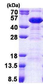 Western blot - Recombinant Human SET/TAF-I protein (His tag N-Terminus) (AB167879)