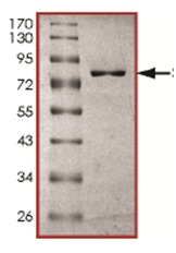 SDS-PAGE - Recombinant human SET7 protein (AB167960), expandable thumbnail