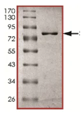 SDS-PAGE - Recombinant human SET7 protein (AB167960)