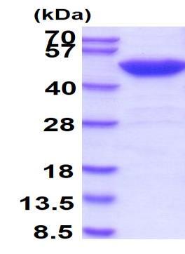 SDS-PAGE - Recombinant Human SET7 protein (AB51285), expandable thumbnail