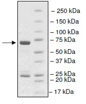 SDS-PAGE - Recombinant human SET7 protein (His tag N-Terminus + GST tag N-Terminus) (AB198126)