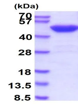 SDS-PAGE - Recombinant Human SET7 protein (Tag Free) (AB51285)