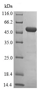 SDS-PAGE - Recombinant Human SET7 protein (Tagged) (AB239446)