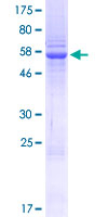 Recombinant Human SETD3 protein