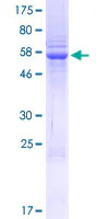 SDS-PAGE - Recombinant Human SETD3 protein (GST tag N-Terminus) (AB132885)