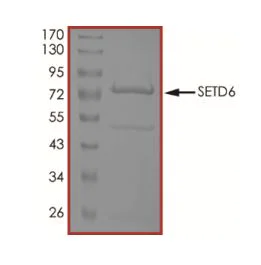 SDS-PAGE - Recombinant human SETD6 protein (Active) (AB268960)