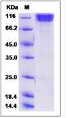 SDS-PAGE - Recombinant Human SEZ6L2 protein (His tag) (AB276605)