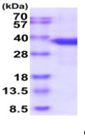SDS-PAGE - Recombinant Human SF2 protein (His tag) (AB219488), expandable thumbnail