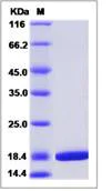 SDS-PAGE - Recombinant Human SF20 protein (His tag) (AB276545)