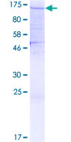 SDS-PAGE - Recombinant Human SF3A1 protein (AB160931)