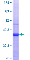 SDS-PAGE - Recombinant Human SF3B3 protein (AB153230), expandable thumbnail