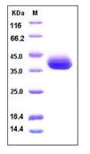 SDS-PAGE - Recombinant human SFRP1 protein (His tag) (AB276300)