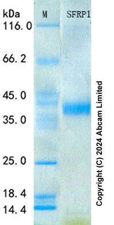 SDS-PAGE - Recombinant Human SFRP1 Protein Standard (His tag) (AB316392)