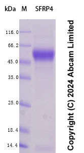 SDS-PAGE - Recombinant Human SFRP4 Protein Standard (His tag) (AB323018)