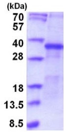 SDS-PAGE - Recombinant Human SFRP5 protein (denatured) (AB202176), expandable thumbnail