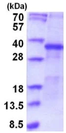 SDS-PAGE - Recombinant Human SFRP5 protein (denatured) (His tag N-Terminus) (AB202176)