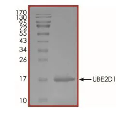 SDS-PAGE - Recombinant human SFT protein (Active) (AB269096)
