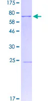 SDS-PAGE - Recombinant Human SGCE/ESG protein (GST tag N-Terminus) (AB160261)