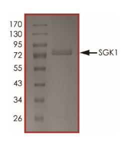 SDS-PAGE - Recombinant human SGK protein (Active) (AB268963), expandable thumbnail