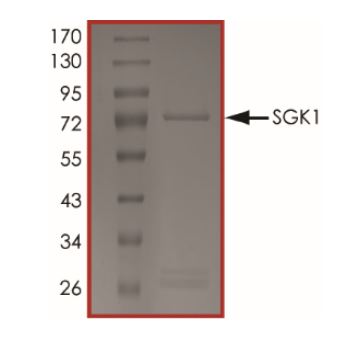 SDS-PAGE - Recombinant Human SGK protein (Tagged) (AB268965), expandable thumbnail