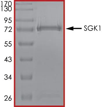 SDS-PAGE - Recombinant human SGK1 protein (AB60883)