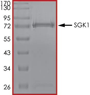 SDS-PAGE - Recombinant human SGK1 protein (AB60883)