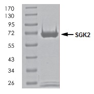 SDS-PAGE - Recombinant human SGK2 protein (Active) (AB261921), expandable thumbnail