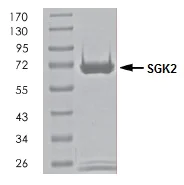 SDS-PAGE - Recombinant human SGK2 protein (Active) (AB261921)