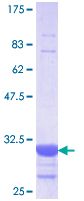 Recombinant Human SGLT2 protein