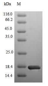 SDS-PAGE - Recombinant Human SGLT2 protein (Tagged) (AB236175), expandable thumbnail